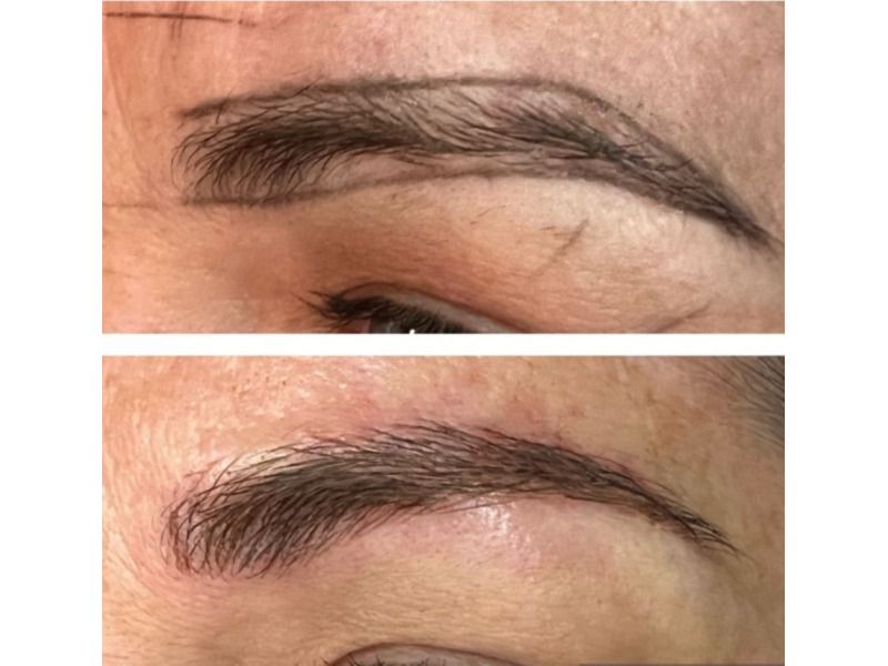 Dermopigmentation Avant Et Apr S Multiesthetique Fr Multiesthetique Fr