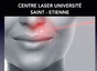 Centre Laser Université Saint-Etienne