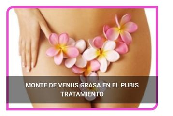 Reduccion del Monte de Venus