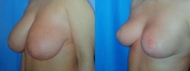 20140727 155609