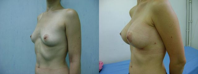 DSC07233