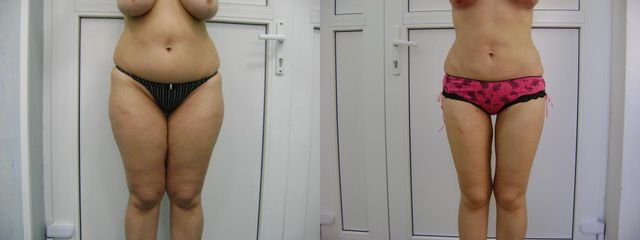 DSC05571
