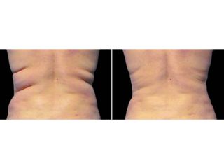 b&a-heartland-f