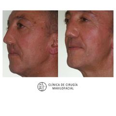 Cirugía maxilofacial - Dr. Antonio Vázquez Rodríguez