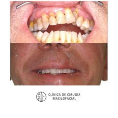Cirugía maxilofacial - Dr. Antonio Vázquez Rodríguez