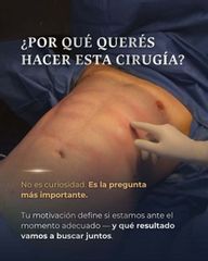 Lipoescultura - Dr Galeazzo Cirugía Plástica | Galmed