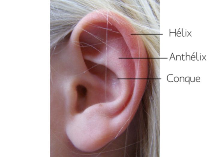 la chirurgie des oreilles