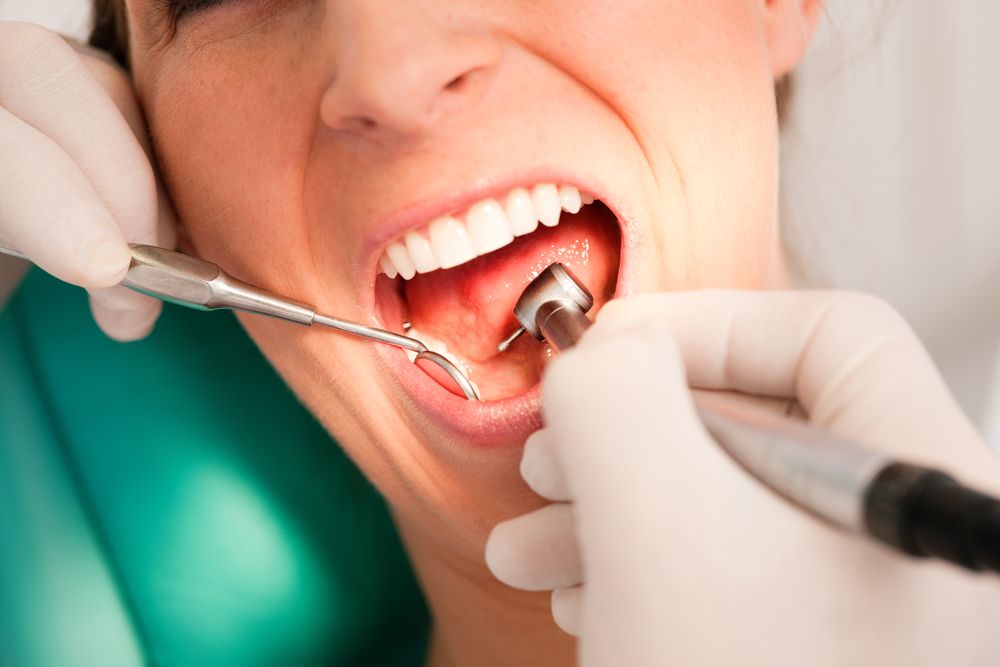 L'orthodontie linguale