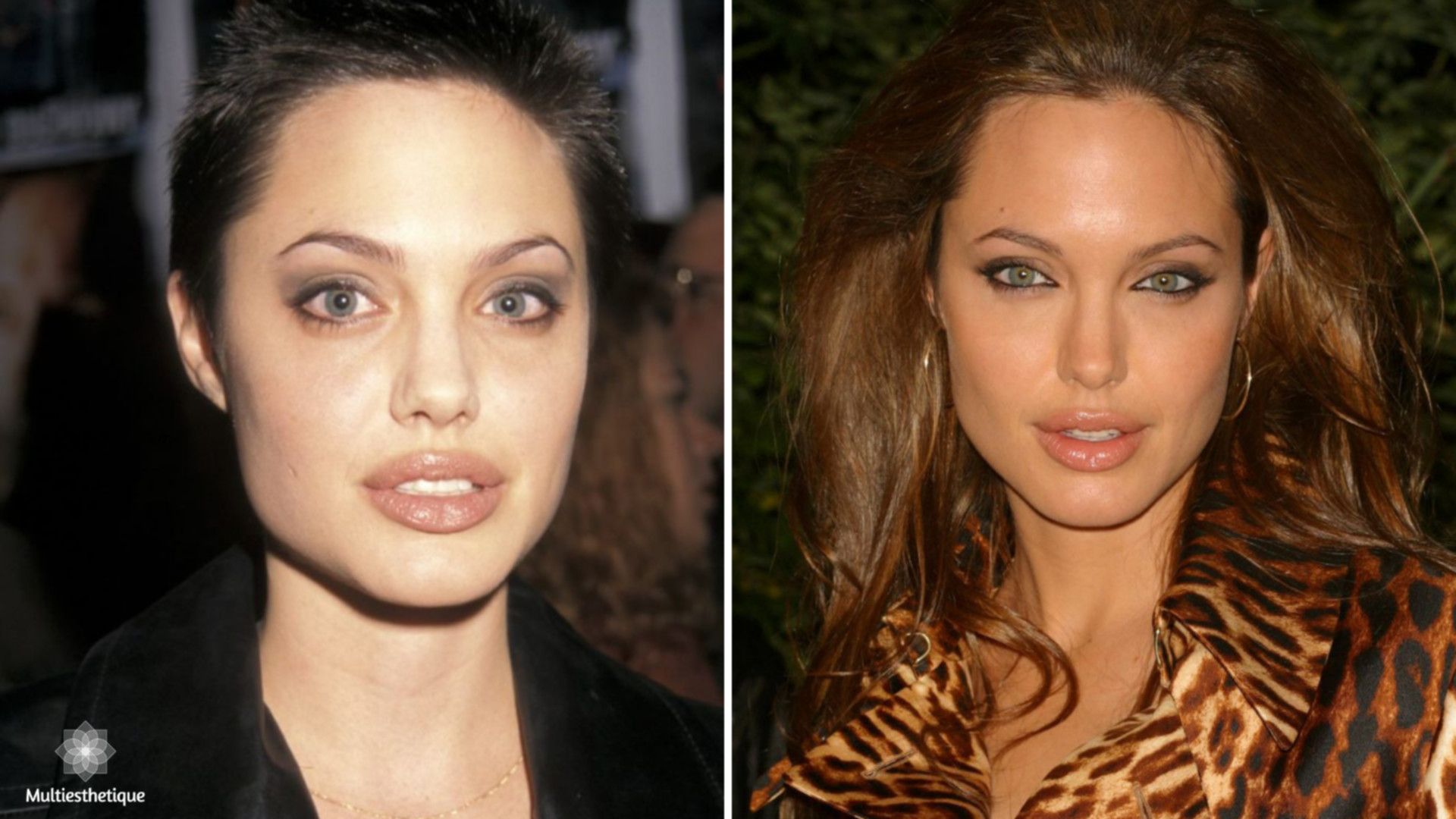 Angelina Jolie avant / après canthopexie