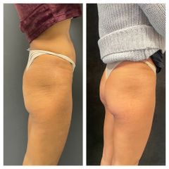 Sculpt - Dr. Gioia Mario