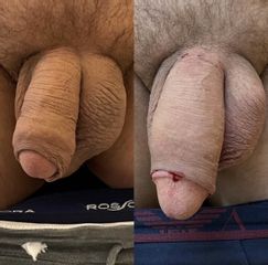 Dr Luca Zattoni - Ingrandimento pene