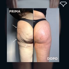 Dott. Dario Martusciello Diamond Incision