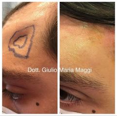 Filler - Aesthetic Clinic del Dott. Giulio Maria Maggi