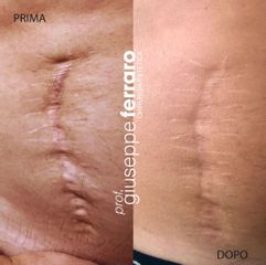Cicatrici - Prof. Giuseppe A. Ferraro
