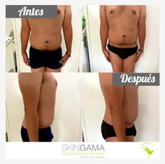 Antes y después de Enzimas