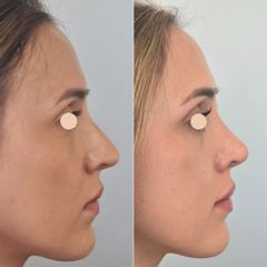 Korekta nosa Dr Maciej Kulicki