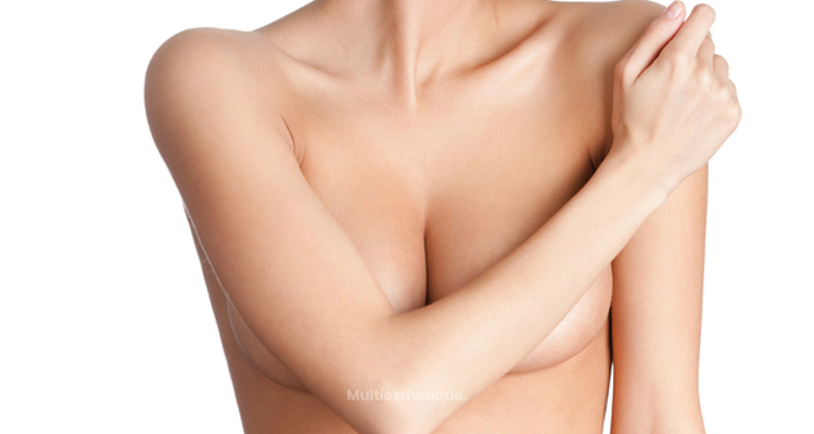 Reconstruction mammaire : le choix des patientes