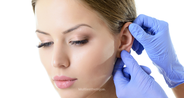 Otoplastie : tout savoir sur la chirurgie des oreilles