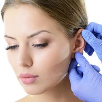 Otoplastie : tout savoir sur la chirurgie des oreilles