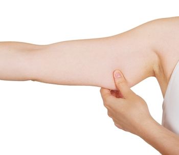 Brachioplastie : pour des bras rajeunis, fermes et toniques