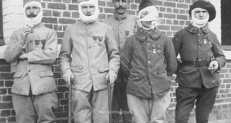 La Première Guerre Mondiale, une étape décisive pour la chirurgie plastique