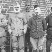 La Première Guerre Mondiale, une étape décisive pour la chirurgie plastique