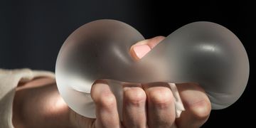 6 idées reçues sur les implants mammaires