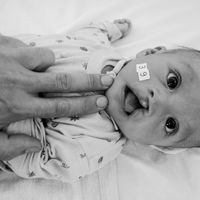 Malformations, l'autre volet de la chirurgie plastique