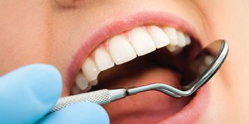 Les différents types de reconstruction dentaire