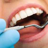 Les différents types de reconstruction dentaire