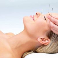 Lifting par acupuncture pour un rajeunissement naturel du visage