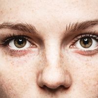 Le post-opératoire de la blépharoplastie