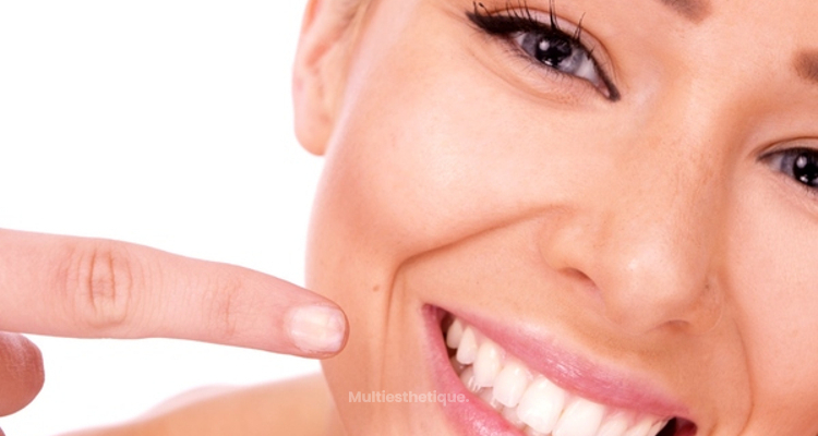 10 choses à savoir sur le blanchiment des dents au laser