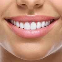 Tout savoir sur la prothèse dentaire fixe