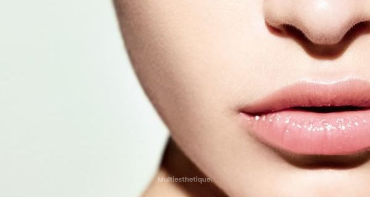 Avantages et inconvénients des implants pour lèvres Permalip