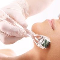 Skin needling, une aiguille qui prend soin de notre peau