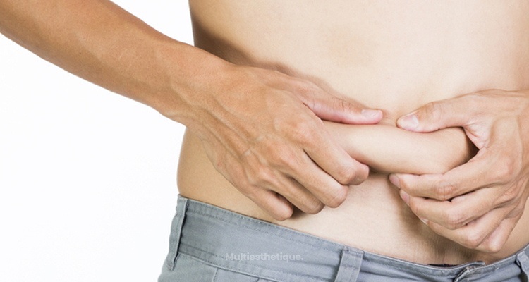 Vaincre les poignées d’amour et les bourrelets abdominaux chez l’homme