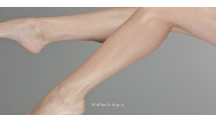CELLULITE CRYOLIPOLYSE ET ONDES DE CHOC