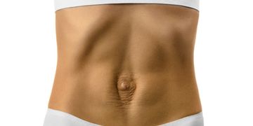 L’abdominoplastie pour venir à bout du diastasis abdominal