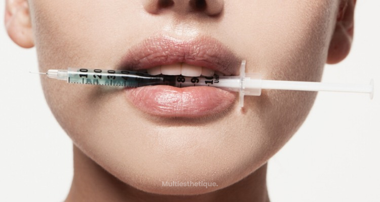 Les utilisations de Botox Off-Label