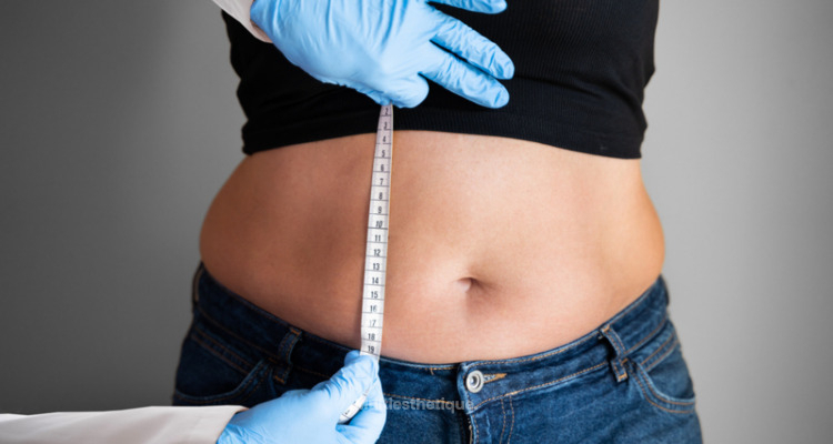 L'abdominoplastie en 15 questions !