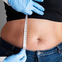 L'abdominoplastie en 15 questions ! L'abdominoplastie en 15 questions !