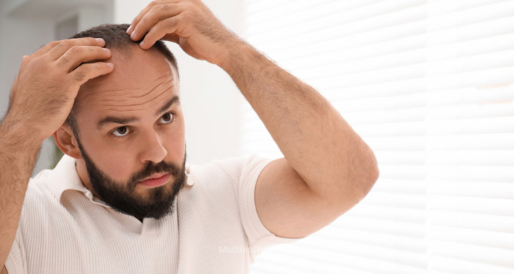 Greffe de cheveux : consultation, traitements capillaires et solutions modernes contre la chute de cheveux