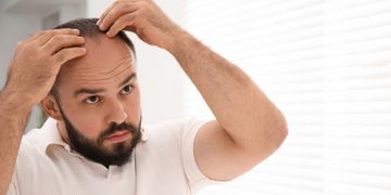 Greffe de cheveux : consultation, traitements capillaires et solutions modernes contre la chute de cheveux Greffe de cheveux : consultation, traitements capillaires et solutions modernes contre la chute de cheveux