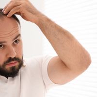 Greffe de cheveux : consultation, traitements capillaires et solutions modernes contre la chute de cheveux
