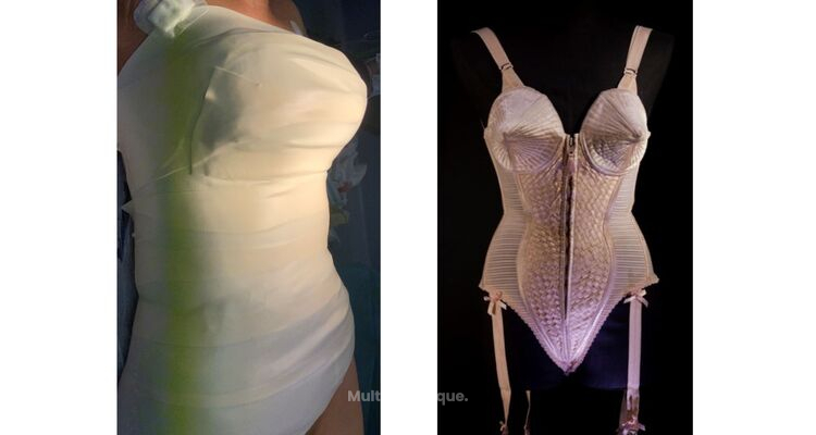 L'intervention « Corset » ou Mommy Makeover à la Française par le Dr Paul SEKNADJE