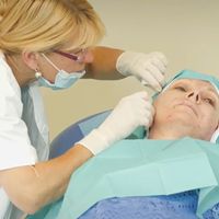 Fils tenseurs résorbables : Une option populaire pour le rajeunissement du visage sans chirurgie
