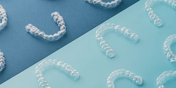 L'orthodontie invisible ou comment retrouver l’envie de sourire