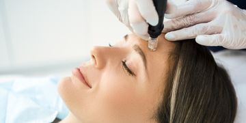 Le microneedling: le Dermapen® et autres appareils super performants