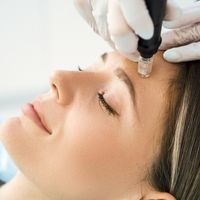 Le microneedling: le Dermapen® et autres appareils super performants